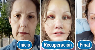 Su transformación fue tan radical que todos se sorprenden cuando dice su verdadera edad