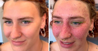 La moda viral de tatuarse la cara con ’’pecas permanentes’’ divide a los usuarios de Internet