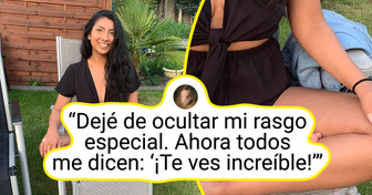 13 Personas con características tan raras que parecen sacadas de un cuento
