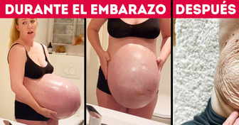 Una madre mostró su enorme barriguita antes del parto, y la gente duda de que sea real