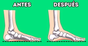 7 Ejercicios de ortopedistas para aumentar la altura del arco plantar y reducir el dolor en el pie