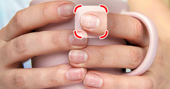 Por qué aparecen estrías en las uñas y qué significan
