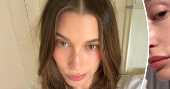 Hailey Bieber muestra su lado más humano al hablar a corazón abierto sobre el problema que sufre en la piel