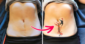 16 Artistas del tatuaje que transformaron las cicatrices en tatuajes excepcionales