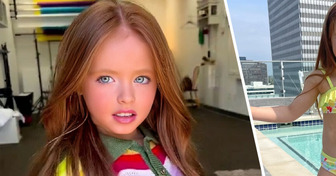 Tiene 8 años y parece una Barbie humana, pero un detalle en su abdomen es lo que llama la atención