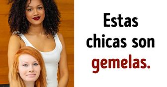 20 Fotos que demuestran que los genes son impredecibles