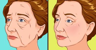 10 Maneras de deshacerse de la flacidez de la piel en la cara y cuello
