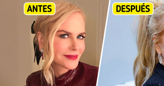 “Señales de estiramiento cerca de sus orejas”: Nicole Kidman impacta con su transformación más reciente