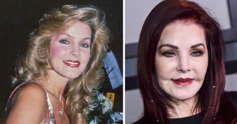 13 Transformaciones de las celebridades gracias a la cirugía estética