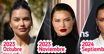 La transformación de Adriana Lima provoca rumores sobre posibles cambios en sus rellenos faciales