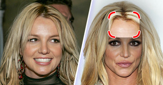 La razón detrás del revuelo por el cambio facial de Britney Spears