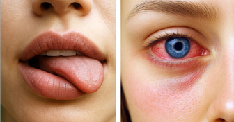 11 Síntomas que no siempre asociamos con la ansiedad, pero tienen mucho que ver con ella