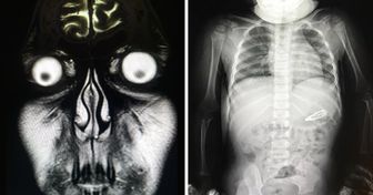 19 Extrañas imágenes de rayos X para aquellos que piensan que lo han visto todo (todavía no superamos la de Bob Esponja)