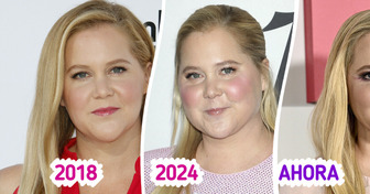 Así fue como Amy Schumer descubrió su problema de salud gracias a comentarios en redes