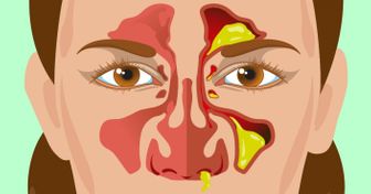 9 Cosas que la mucosidad en tu nariz dice sobre tu salud