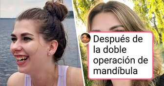 18 Personas que gracias a una cirugía lograron brillar más que siempre