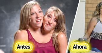 Abby y Brittany: maestras siamesas que transforman su vida en un mensaje de amor