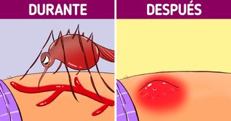 Qué le sucede a tu cuerpo cuando te pica un mosquito