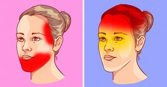 9 Tipos de dolor de cabeza que pueden ser causados por problemas de salud