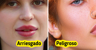 10 Tratamientos de belleza que podrían darte más dolores de cabeza que resultados