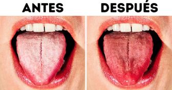 10 Maneras de deshacerse de la lengua blanca y hacerla más saludable