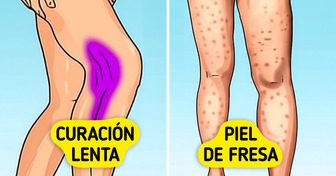 7 Signos de que tu cuerpo puede necesitar más colágeno