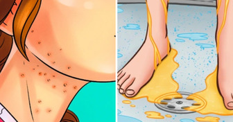 9 Síntomas comunes de diabetes que podrían estar frente a tus ojos