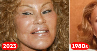 La reveladora imagen de Jocelyn Wildenstein que nos hace pensar en su increíble cambio