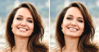 15 Fotos que muestran cómo los dientes pueden cambiar el rostro