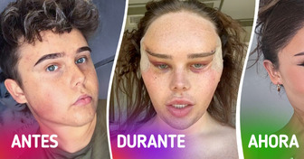 Influencer trans revela los impactantes resultados de su cirugía de ojos “foxy”