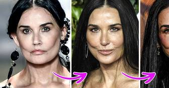 Demi Moore y su impactante transformación facial, esto es lo que dicen los expertos