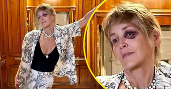 Sharon Stone compartió una foto con un ojo morado y dejó preocupados a sus fans