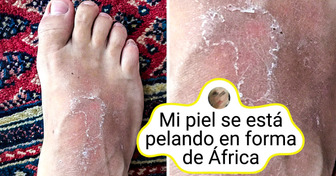 13 Pruebas de que nuestro cuerpo puede tener más trucos que Batman bajo su traje