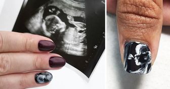 Mujeres embarazadas están usando sus ecografías como manicura, y el resultado es realmente adorable