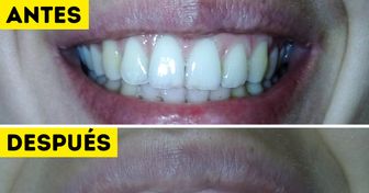 Verificamos 5 maneras caseras de blanquear los dientes (El bicarbonato de sodio nos decepcionó)