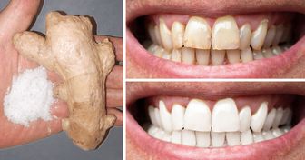 8 Maneras naturales de blanquear tus dientes en casa