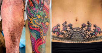 20 Valientes que cambiaron las imperfecciones de su piel por tatuajes artísticos