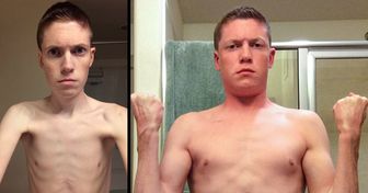 25 Hombres que compartieron las fotos del “antes” y el “después” de los drásticos cambios en su vida