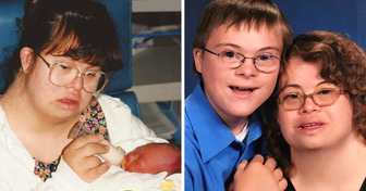 Cómo una mujer con síndrome de Down dio a luz a un niño con la misma condición y lo crió como madre soltera