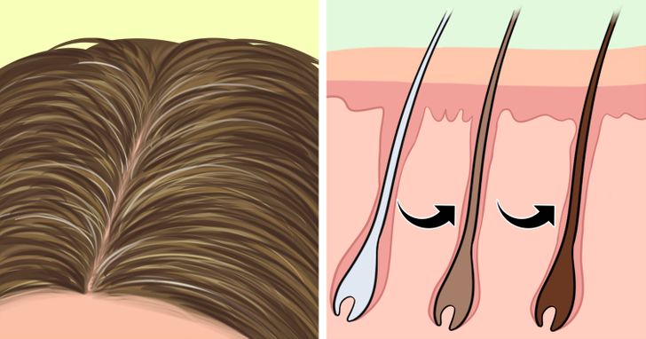 Las canas pueden ser reversibles, y hay varias formas de devolverle el color al cabello
