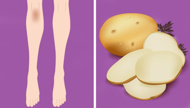 10 Remedios naturales para aclarar la piel de las rodillas y los codos