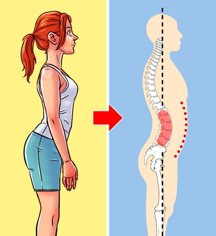 4 Tipos de mala postura y cómo corregir cada uno de ellos / Genial