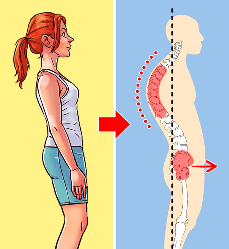 Dolor de espalda: consecuencias de una mala postura corporal