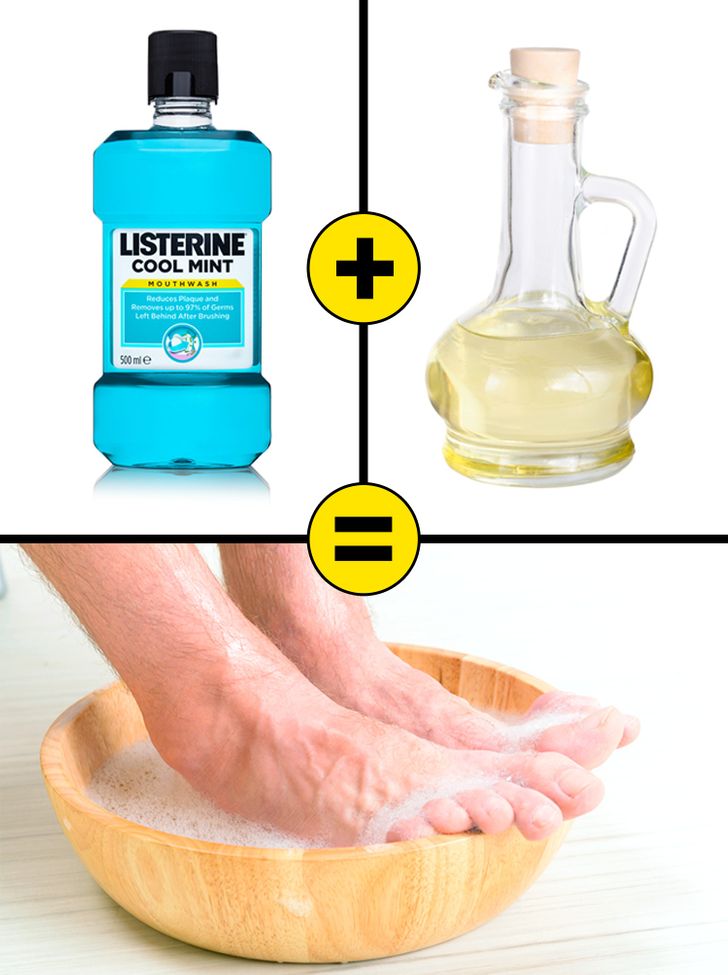 10 Remedios caseros para sanar los talones agrietados y tener pies hermosos