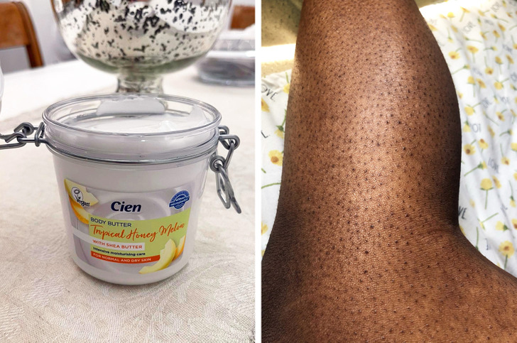 7 Remedios caseros para tratar la piel de fresa lucir unas piernas suaves y radiantes