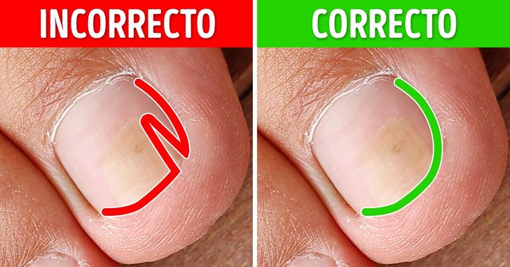Cómo curar las uñas huecas de los pies