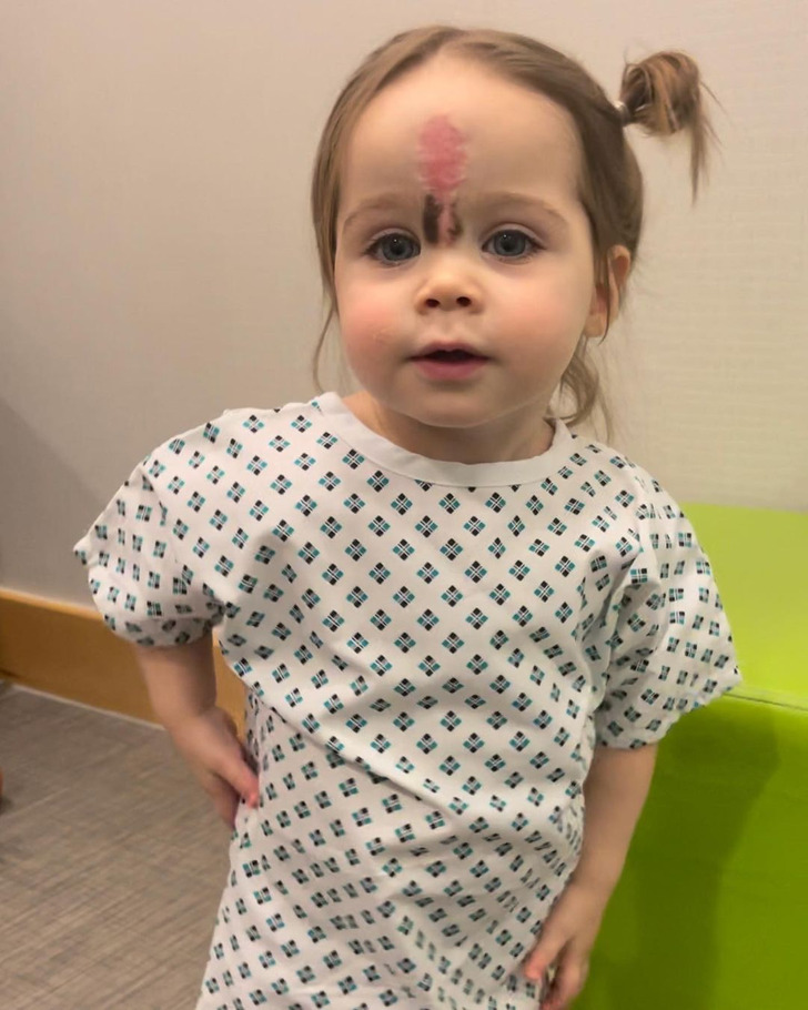 A young kid wearing hospital clothes with a scar between her eyes.