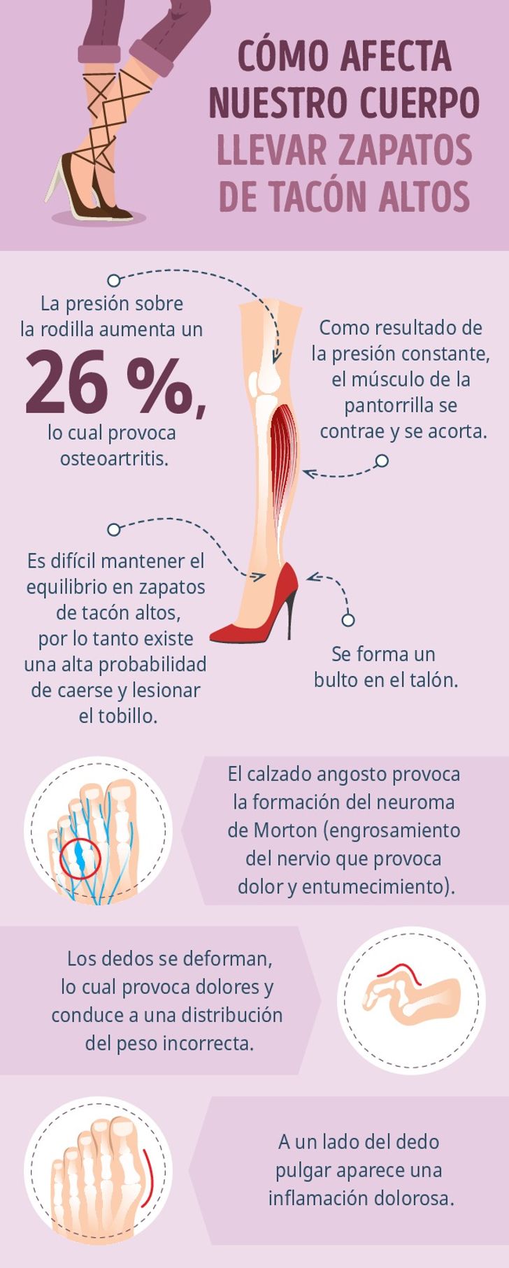 Cómo usar tacones correctamente sin perjudicar tu salud / Genial