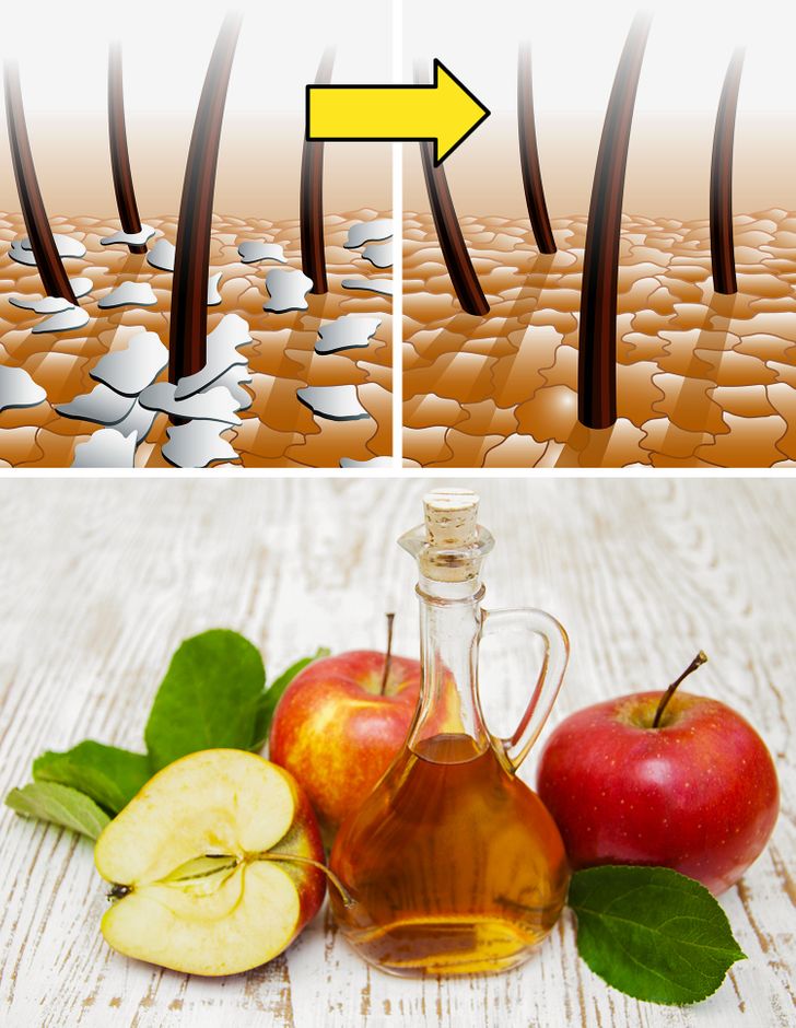 Los múltiples usos del vinagre de manzana que pueden hacer tu vida más fácil
